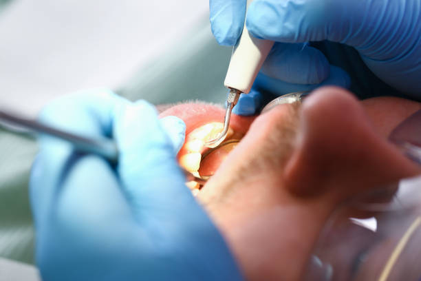 Best Cosmetic Emergency Dentistry in Charlotte Hall, MD